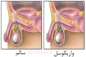 معجون واریکوسل وارداتی/طب سنتی هندی ایرانی با ده گرم ژل رویال---یک کیلو